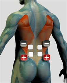 Rozmieszczenie elektrod na mięśniach kręgosłupa - prostownik A