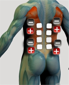 Rozmieszczenie elektrod na mięśniach kręgosłupa - prostownik B
