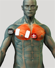 Umieszczenie elektrod na klatce piersiowej - A